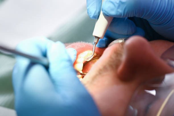 Best Emergency Care for Gum Disease in Moundville, AL